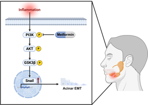 Metformin Attenuates Partial Epithelial-Mesenchymal Transition in Salivary Gland Inflammation via PI3K/Akt/GSK3β/Snail Signaling Axis