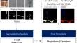 Rs-net: Residual Sharp U-Net architecture for pavement crack segmentation and severity assessment