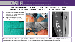 Combination of Elastic Nail(s) and Cementoplasty to Treat Pathological Fractures in Long Bones of the Upper Limb.