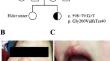 De Novo Deep Intron ELANE Mutation Resulting in Severe Congenital Neutropenia.