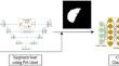 Automatic Diagnosis of Hepatocellular Carcinoma and Metastases Based on Computed Tomography Images.