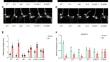 The cross-talk of brassinosteroid signaling and strigolactone signaling during mesocotyl development in rice