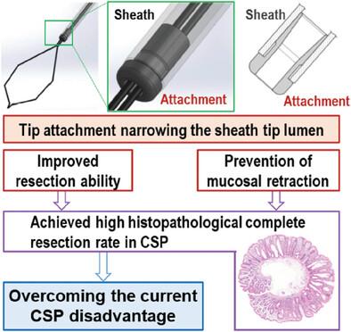 High‐Performance Dedicated Snares with Tip Attachments can Overcome Current Disadvantages in Cold Snare Polypectomy