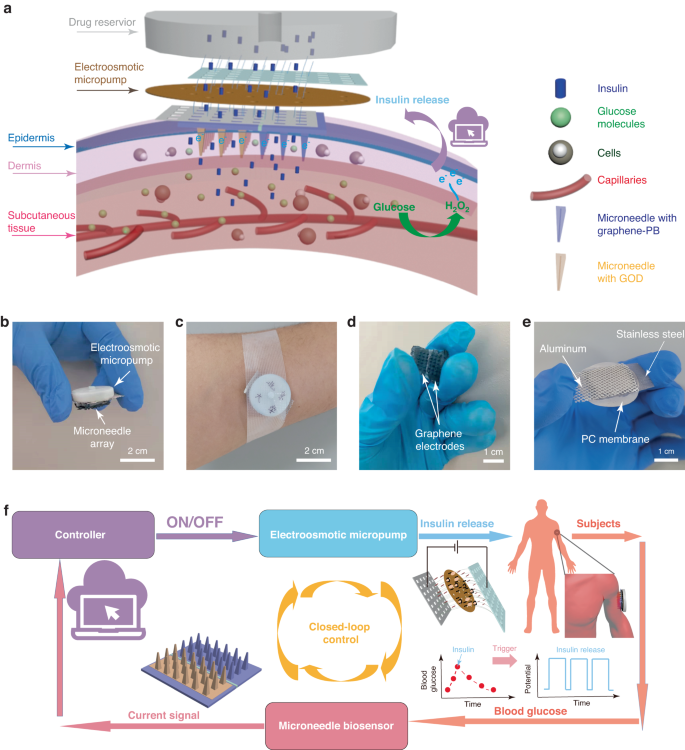 A wearable, rapidly manufacturable, stability-enhancing microneedle patch for closed-loop diabetes management.