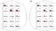 EEG Sensorimotor Rhythms Dynamics in Children with Cerebral Palsy during the Course of Neurorehabilitation, Depending in the Success of Their Imagination of Movements