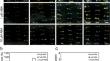 ABA inhibits in vitro shoot regeneration by affecting H3K9ac modification of WUS in Arabidopsis.