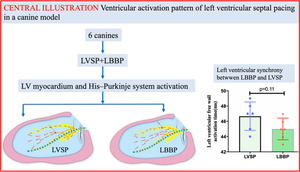 Ventricular activation pattern of left ventricular septal pacing in a canine model.