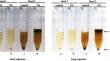 Improvement of the Diagnostic Method for the Detection of Parasite Eggs Using the Formalin Ethyl Acetate Concentration Technique.