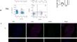 The relationship between CXCR6+CD8+T cells and clinicopathological parameters in patients with primary biliary cholangitis.