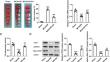 Electroacupuncture Ameliorates Neuronal Damage and Neurological Deficits after Cerebral Ischemia-Reperfusion Injury via Restoring Telomerase Reverse Transcriptase.