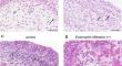 Mitochondrial viability in neurogenic bladder urothelium after sigmoidocolocystoplasty. Implications for persistent vesicoureteral reflux.