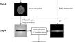 Improving the lesion appearance on FLAIR images synthetized from quantitative MRI: a fast, hybrid approach.