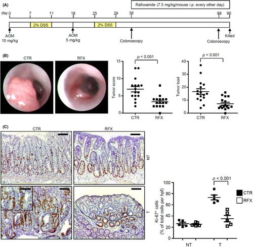 Rafoxanide negatively modulates STAT3 and NF-κB activity and inflammation-associated colon tumorigenesis