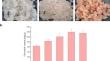 Insights into the molecular mechanism underlying cold-induced flavonoids biosynthesis in callus of a Tibetan medicinal plant Saussurea laniceps