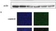 Quantitative proteomic analysis of PK-15 cells infected with porcine circovirus type 3 using 4D-DIA approach.