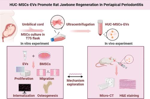 Human Umbilical Cord Mesenchymal Stem Cells-Derived Extracellular Vesicles for Rat Jawbone Regeneration in Periapical Periodontitis.