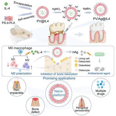 A promising platform of nanovesicles as a synergistic strategy for antibacterial and immunomodulation in treating periodontitis