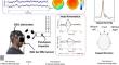 Immediate and Transient Perturbances in EEG Within Seconds Following Controlled Soccer Head Impact