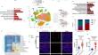 WNT2B high‑expressed fibroblasts induce the fibrosis of IBD by promoting NK cells secreting IL-33.