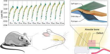 Bioinspired triple-layered membranes for periodontal guided bone regeneration applications