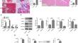 METTL3 silencing inhibits ferroptosis to suppress ovarian fibrosis in PCOS by upregulating m6A modification of GPX4