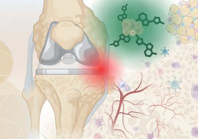 Aggregation-induced emission biomarkers for early detection of orthopaedic implant failure