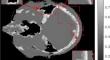 Sparse-view neutron CT 3D image reconstruction algorithm based on split Bregman method