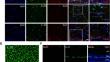 The IL-33/ST2 Axis Protects Retinal Ganglion Cells by Modulating the Astrocyte Response After Optic Nerve Injury.