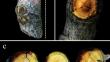 Emerging Fig Black Necrosis incited by Butlerelfia eustacei and its potential impact on various fig cultivars