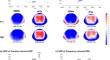 Mismatch Negativity and P3a in Unaffected Siblings of Individuals with Autism Spectrum Disorder and the Exploration on the Neurocognitive Implications.