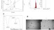 Chitosan-Coated Scorpion Venom Ameliorates Acute Lung Injury Caused by Klebsiella Pneumoniae