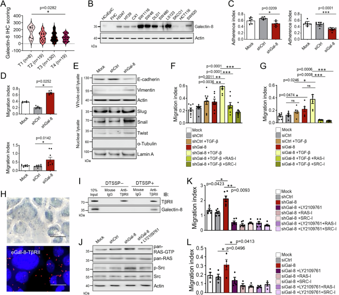 B4GALT1-dependent galectin-8 binding with TGF-β receptor suppresses colorectal cancer progression and metastasis.