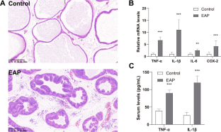 Chronic prostatitis/chronic pelvic pain syndrome impairs erectile function by inducing apoptosis in a rat model of experimental autoimmune prostatitis.