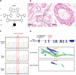 A novel homozygous nonsense variant of STX2 underlies non-obstructive azoospermia in a consanguineous Chinese family.