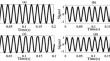 Setting-Less Differential Protection of Power Transformers Based on Wavelet Transform