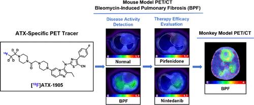 Imaging Pulmonary Fibrosis and Treatment Efficacy In Vivo with Autotaxin-Specific PET Ligand [<sup>18</sup>F]ATX-1905.