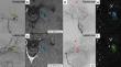 Evaluation of micro-remnant niduses of arteriovenous malformations post-gamma knife radiosurgery by 3D-rotational angiography.