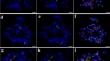 Introgression of tetraploid <i>Thinopyrum elongatum</i> 6EL segments enhances the stripe rust resistance of adult wheat plants.