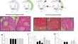 The Protective Effect of GnRH Agonist Triptorelin on the Histomorphometric Parameters of the Utero-ovarian Tissue in the Doxorubicin- and Cyclophosphamide-treated Mice.