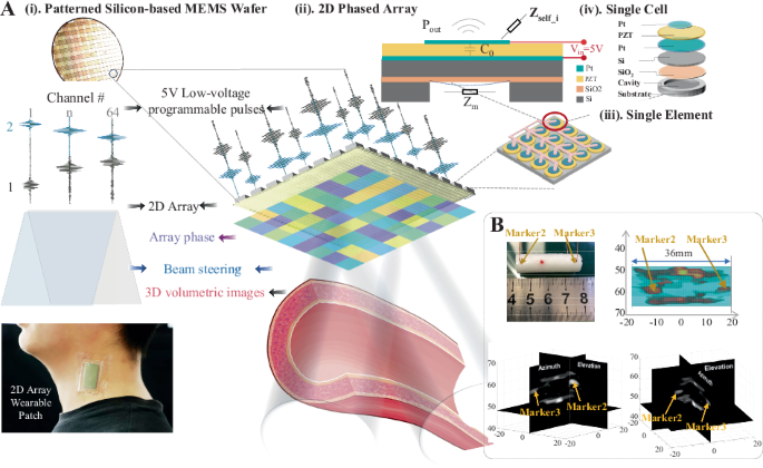 A low-voltage-driven MEMS ultrasonic phased-array transducer for fast 3D volumetric imaging