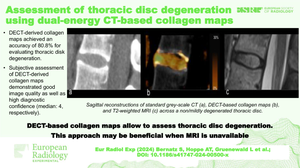 Assessment of thoracic disc degeneration using dual-energy CT-based collagen maps.