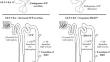 GLP-1 receptor agonists may enhance the effects of desmopressin in individuals with AVP deficiency: a case series and proposed mechanism.