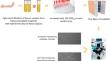 CoronaVac-vaccinated kidney transplant recipients with hybrid immunity have strong neutralizing responses against Omicron and Mu variants of SARS-CoV-2