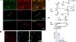 Functional Upregulation of TRPM3 Channels Contributes to Acute Pancreatitis-associated Pain and Inflammation