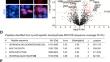 Lys-63-specific deubiquitinase BRCC36 enhances the sensitivity of multiple myeloma cells to lenalidomide by inhibiting lysosomal degradation of cereblon.