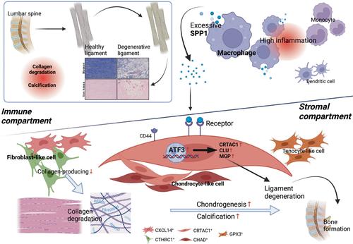 Single-cell RNA sequencing reveals the CRTAC1<sup>+</sup> population actively contributes to the pathogenesis of spinal ligament degeneration by SPP1<sup>+</sup> macrophage.