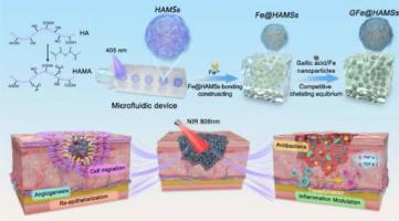 Multifunctional microsphere dressings via metal ligand bonding engineering for infectious wound healing