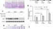 RIP3 regulates doxorubicin-induced intestinal mucositis via FUT2-mediated α-1,2-fucosylation.