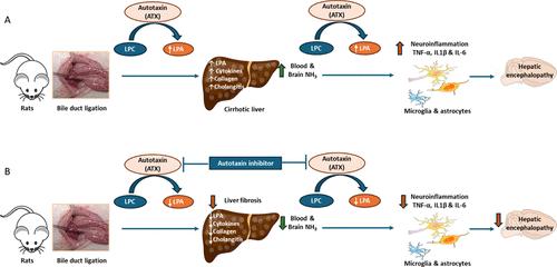 Effect of an Autotaxin Inhibitor, 2-(4-Chlorophenyl)-7-methyl-8-pentylimidazo[1,2-a] Pyrimidin-5(8H)-one (CBT-295), on Bile Duct Ligation-Induced Chronic Liver Disease and Associated Hepatic Encephalopathy in Rats