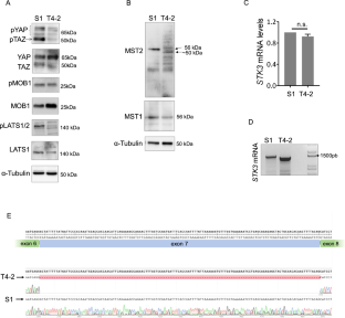 Identification of a novel alternative splicing isoform of the Hippo kinase STK3/MST2 with impaired kinase and cell growth suppressing activities.